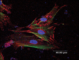 Confocal image of osteoblast cells attaching on silicon-substituted hydroxyapatite nanocrystals